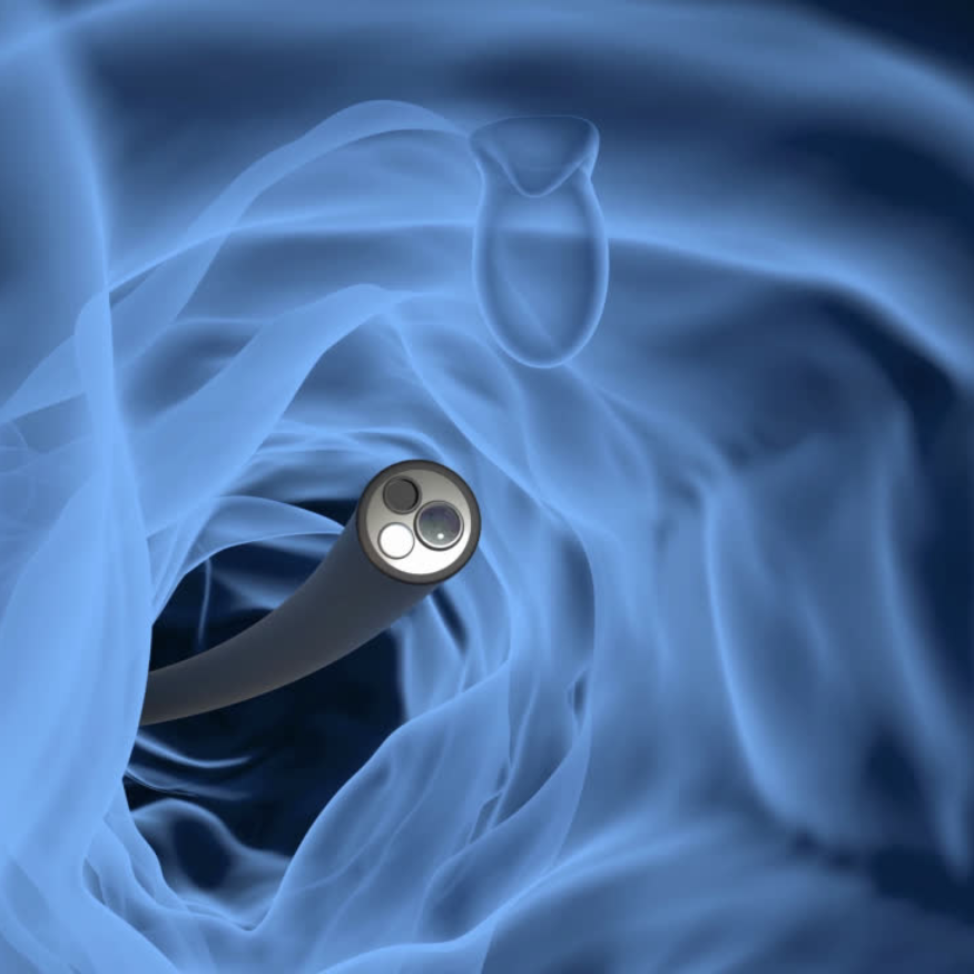 Colonoscopia - Pruebas